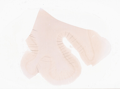 ['deident_b8555e5b-3bbf-4e7e-a555-779e7348e3c2_69b0650e.jpg']