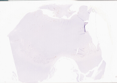 ['deident_6d35fb56-bac9-4216-8bf6-9d45ad456ab2_69b064ee.jpg']