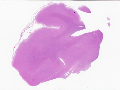 ['deident_2c185e8d-27dc-48fd-b01b-9d94f2a095fe_69b064d2.jpg']