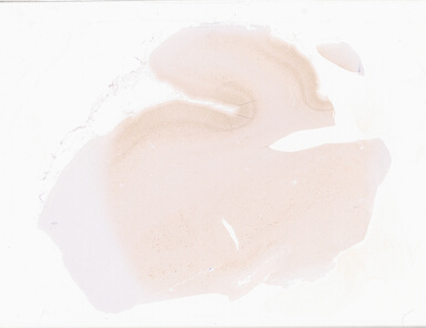 ['deident_e50790dd-ff2b-4121-832e-4a8fabb8d7bd_69b06523.jpg']