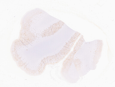 ['deident_8a5cd026-5119-4ad2-833e-2aae852b402e_69b06502.jpg']