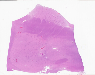 ['deident_be19e924-b7a7-4370-9ecf-184f32975065_69b06510.jpg']