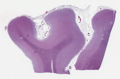 ['deident_a4f66035-14ac-4cc5-a710-cdc121b72934_695fc8bc.jpg']
