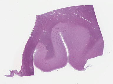 ['deident_ef874c9c-460f-48ca-8fcf-ec75cc557e26_695fc8db.jpg']
