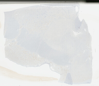 ['deident_e0889701-7e81-47e5-b8d8-dc3f79bc32c3_695fc8d8.jpg']