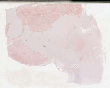 ['deident_8b044e0c-bb45-48ae-8f2b-c8b95e082366_695fc8b2.jpg']