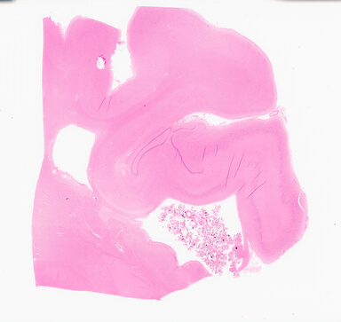 ['deident_f0fb17f3-5791-443a-b3ee-2377a87ecadd_695fc8dd.jpg']