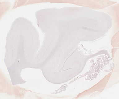 ['deident_cc9c6b67-5fac-4479-ba06-ce37cf671923_695fc8c8.jpg']