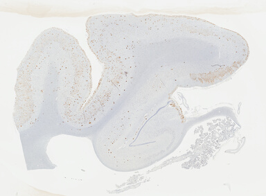 ['deident_d56cd8b7-9f18-4a5a-a82c-718f9e744a10_695fc8d0.jpg']
