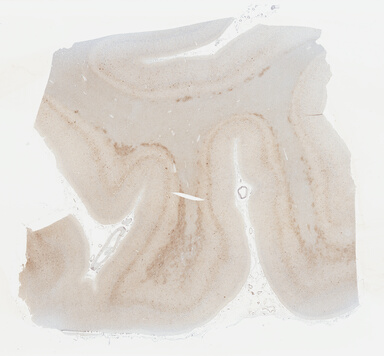 ['deident_0eb00859-ed51-437d-a91f-ca030e16600a_695fc898.jpg']