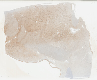 ['deident_71a2fd48-7a56-4418-9213-33316588d5f8_695fc8aa.jpg']