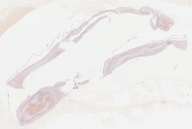 ['deident_f19c2cc3-467c-4701-8667-4b91f78161ee_695fc8df.jpg']