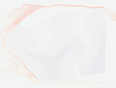['deident_b33dd8d6-841a-4538-9396-71cf85f7bdd3_695fc8c1.jpg']