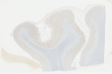 ['deident_d2f82fa4-584c-4c83-80e0-44895072c223_695fc8cd.jpg']