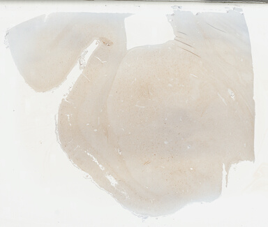 ['deident_c098df7c-1603-4614-84a9-c96adf31428d_69b04823.jpg']