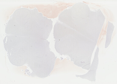 ['deident_5a1fb438-594a-4252-b6ee-0beb5ba76bad_69b04800.jpg']