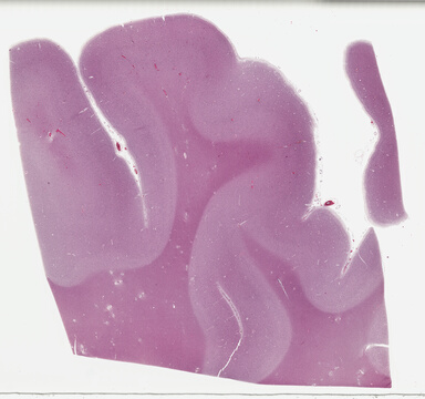 ['deident_20c4199b-bb74-45a2-99b0-ce542c84eec5_69b047ee.jpg']