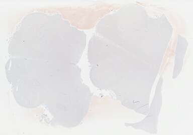 ['deident_f74bcfe2-27c4-4ddf-a5f9-b19b15c61c45_69b04842.jpg']
