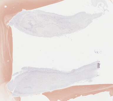 ['deident_b29622bb-34f7-40d7-bd1b-a3c559ae4d64_69b0481b.jpg']