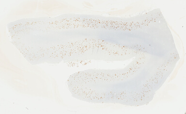 ['deident_224fe222-3aba-403f-ad32-80f7d61fa1bf_69b047f4.jpg']