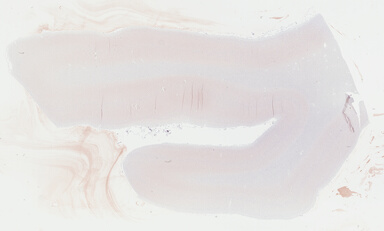 ['deident_58a5928a-42bb-4c47-8bec-a27115978369_69b047fd.jpg']