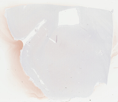 ['deident_f43d1c85-c5fe-4ddc-aefb-5eed702c8142_69b04840.jpg']