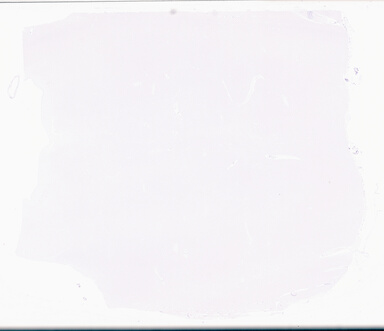 ['deident_c4933afe-c513-4625-9955-3626b8a0d594_69b04825.jpg']