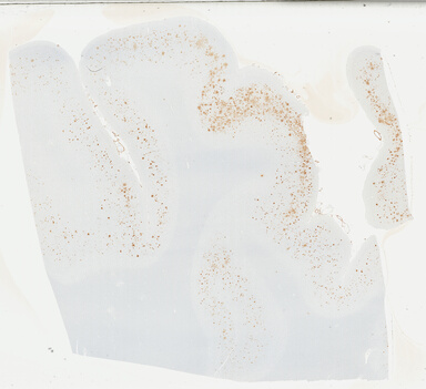 ['deident_d92db36d-09ae-4c30-807f-fe5e368f259f_69b04839.jpg']