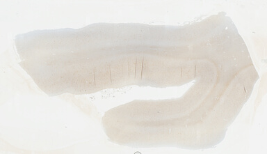 ['deident_95f03f82-2cd6-421d-a161-70a8d5fcf075_69b0480c.jpg']