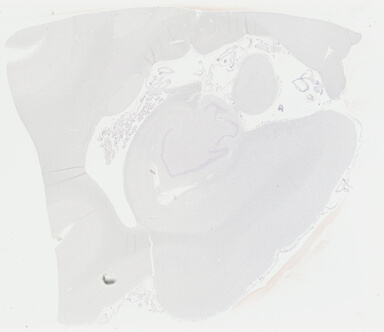 ['deident_0a64eab5-9ebb-47a3-a885-1c3fdd617767_69b047e6.jpg']