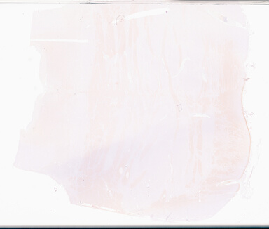 ['deident_6bb4686b-1502-45c1-9080-fe1da40d0fd3_69b04806.jpg']
