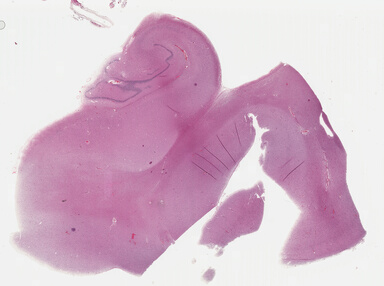 ['deident_095d5a8f-6c7b-4a81-b8fa-dd6a8df4d732_69b047e3.jpg']