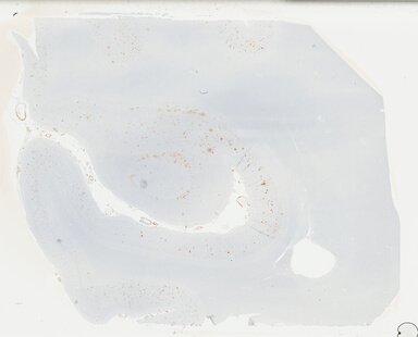 ['deident_2b0bd5a4-e1cd-4e8c-9523-16f77548a708_69b047f7.jpg']