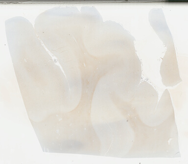 ['deident_e9034097-7bd9-42f5-9c30-683c6ef64e7d_69b0483e.jpg']