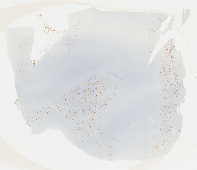 ['deident_9e274306-c68a-450c-9706-356f05436934_69b04816.jpg']