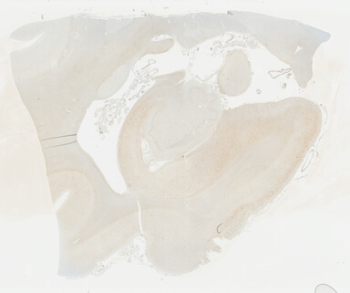 ['deident_13f442bd-4675-4d68-b599-f37ed8e36078_69b047ed.jpg']
