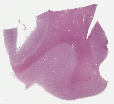 ['deident_8cbaaf36-6ae3-4bd5-ad3e-0602541dedda_69b0480b.jpg']