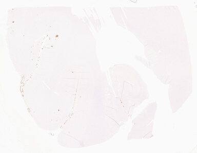 ['deident_bfbe8070-4c31-4536-b201-77929074ee76_69d967bd.jpg']