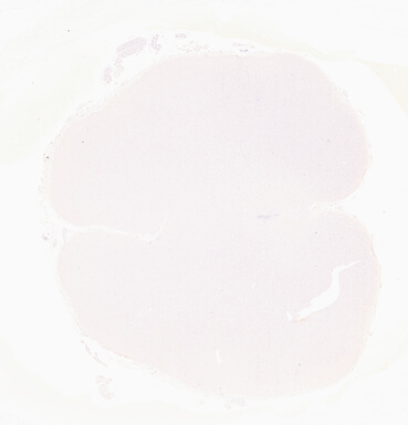 ['deident_28ded959-73cc-41f5-82ff-b60f867554a6_69d96761.jpg']