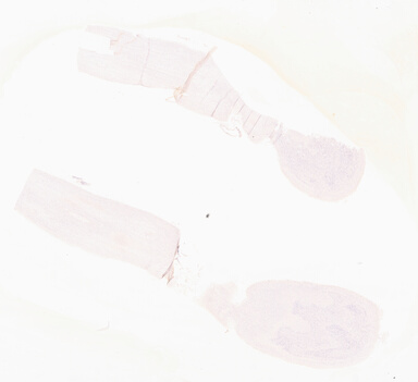['deident_b3966f9d-d729-4a16-b7d8-7be066b9fd39_69d967b2.jpg']