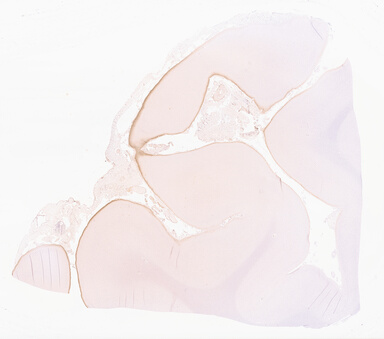 ['deident_ae4d4b21-c280-42f6-a0ab-cfb64bae8f74_69d967af.jpg']
