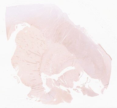 ['deident_aba6e1d7-3d93-4644-9f32-9502be0452bc_69d967ab.jpg']