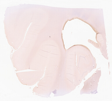 ['deident_9592decf-36f4-4d64-ae84-9c56419ebb0a_69d96795.jpg']