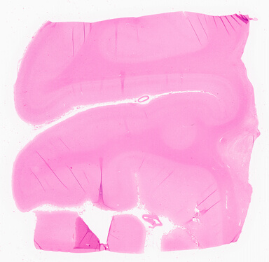 ['deident_c3499df4-2da1-49e0-af87-b413959694be_69d967bf.jpg']