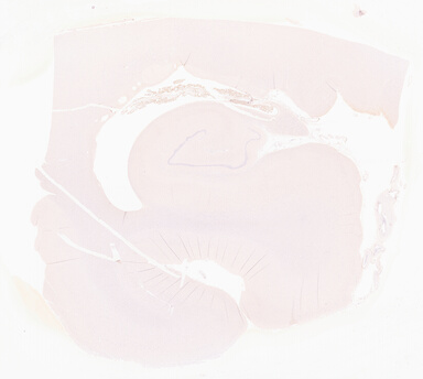 ['deident_5a0e77dc-1432-4a9f-9b8f-2be0e1f60f06_69d9677e.jpg']