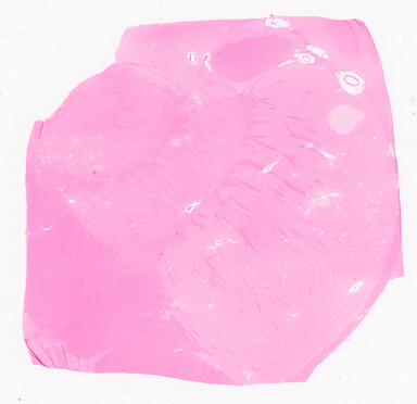 ['deident_559dfb50-c6d3-4e78-b92b-700a766175e5_69d9677d.jpg']