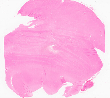 ['deident_4fde5c68-2d1b-4cfa-a316-0d93a6ff1aa0_69d96775.jpg']