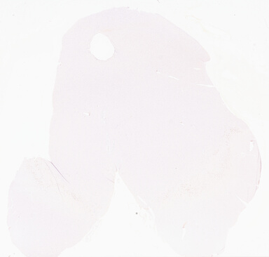 ['deident_31019dd5-2f87-4920-ae39-bc6ab327d716_69d96768.jpg']