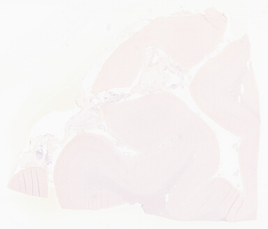 ['deident_a670ab27-e2fe-4532-9a99-9ce89ea04af6_69d967a8.jpg']