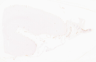 ['deident_06768319-4ab4-41e0-aa9c-abd00103adf1_69d96759.jpg']